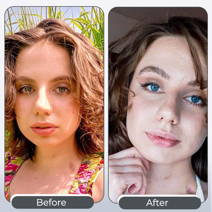 Odeiun™ Eye Color Changing Drops – 2-Hour Transformation, Lasts 5–7 Days